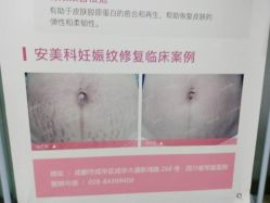 -成都军建医院·疤痕诊疗中心