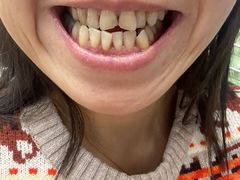 -天使口腔门诊部(上海店)