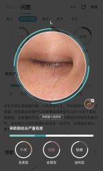 体验后-SKINIST丽铂医疗美容