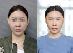 -加减美医美连锁品牌