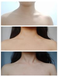-上海漾颜医疗美容