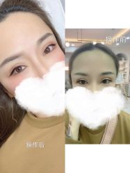 点击看大图 -Verywang半永久纹眉•仪器野生眉