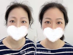 -MIVI野生眉纹绣纹眉