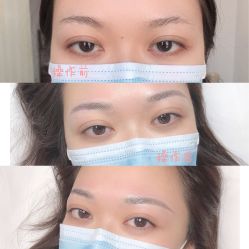 -久匠半永久纹眉