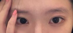 -北京叶子整形美容医院