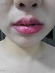-美莱医疗美容医院