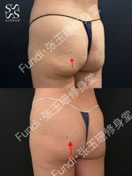 -Fundi张玉珊修身堂·indiba·BTL科技瘦身