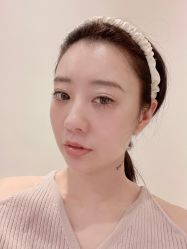 体验后-美莱医学美容医院