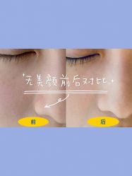 体验前-时光海科学美肤中心