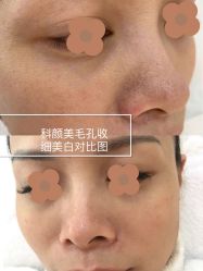 -美肤盾祛痘·问题肌头疗管理中心