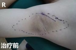 -SKINIST丽铂医疗美容