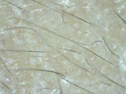 -雍禾植发全国连锁