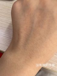体验前-上海漾颜医疗美容