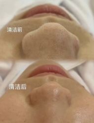 -LUNA皮相美·骨相美高级美感