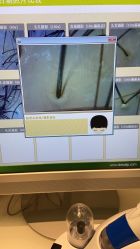 -LESSMORE科技头皮理容中心