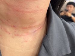 -美莱医疗美容医院