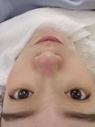 -痘博士天津·全国连锁祛痘机构