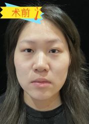 -素美医疗美容·西南眼鼻整形·修复基地
