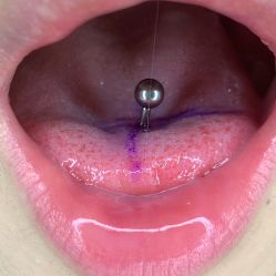 -脱白计划纹身集团