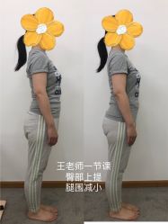 -卓拓普拉提