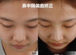-北京米扬丽格医疗美容·联合丽格鼻整形中心