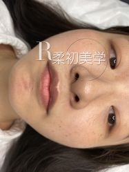 -RC半永久纹眉纹发际线