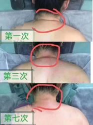 -丽减美瘦吧·减肥瘦身