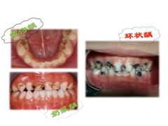 -团圆口腔·种植中心(锦江院区)