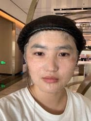 体验前-铂诗玥医美