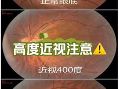 -中科优视医学研究院·验光配镜·近视防控