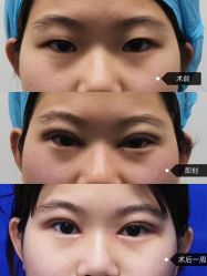 -温州伯思立医院