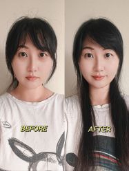 点击看大图 -广州健丽·去眼袋医疗美容机构