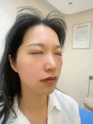 -四川米兰柏羽医学美容医院