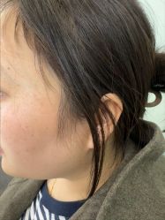 -长沙雅美医疗美容医院