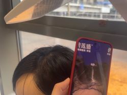 -碧莲盛·不剃发植发