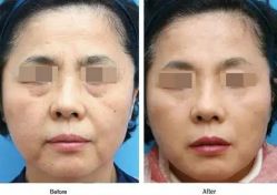 -北京米扬丽格医疗美容·联合丽格鼻整形中心