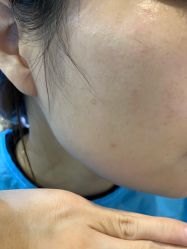 体验后-天津伊美尔医疗整形美容专科医院