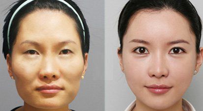 -CMS西美斯·美式医疗美容