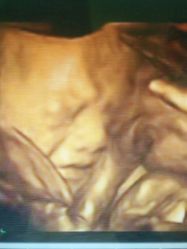 -杭州贝瑞斯美华妇儿医院·早孕·产检·儿科