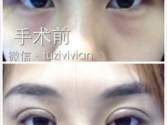 -上海华安整形外科门诊部