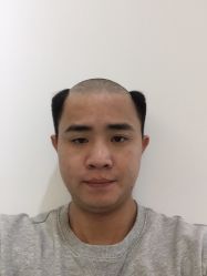 -发饰美男士增发补发假发定制店