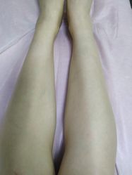 点击看大图 -薇兰专业脱毛连锁机构