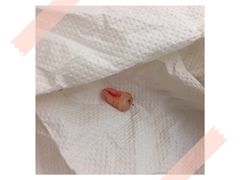 -上海市杨浦区牙病防治所