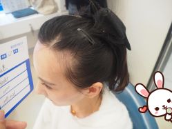 -大麦微针植发丨全国连锁