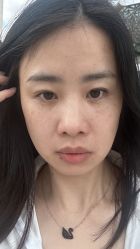 -广州健丽·去眼袋医疗美容机构