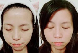 点击看大图 -SKINIST丽铂医疗美容