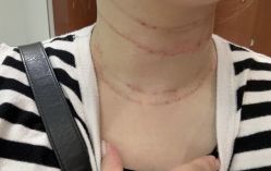 -agge蛋白医美