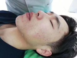 -苗方清颜痘肌研究所