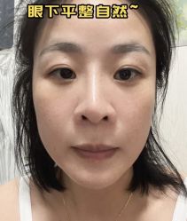 -天津健丽·去眼袋医疗美容机构