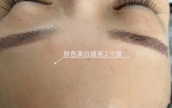 -佛山艺美医疗美容·整形·美肤·塑形